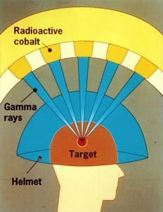 Gamma_Knife_Graphic